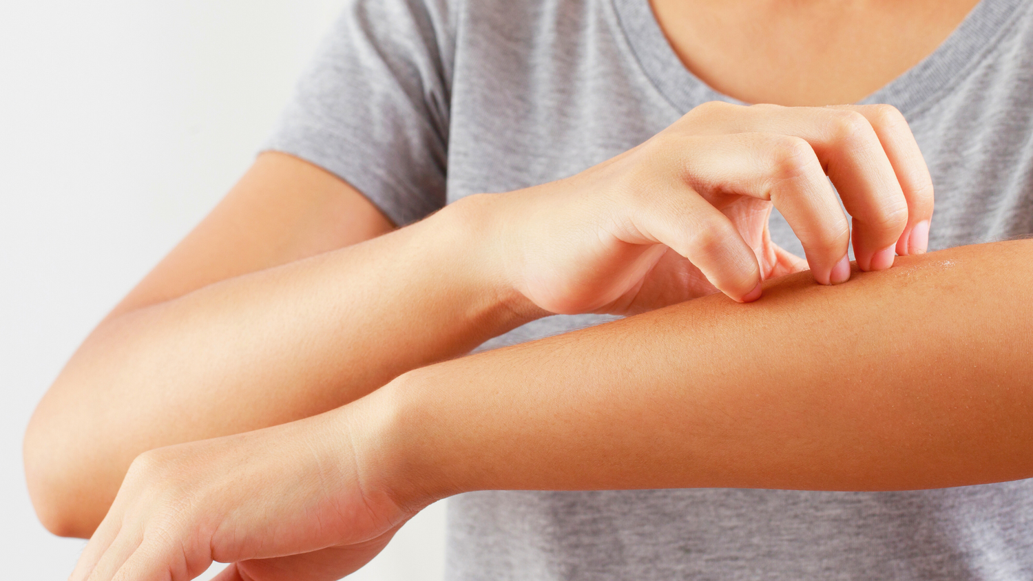 Preparing Your Skin for Allergy Season: Skincare Tips and Understanding Allergies