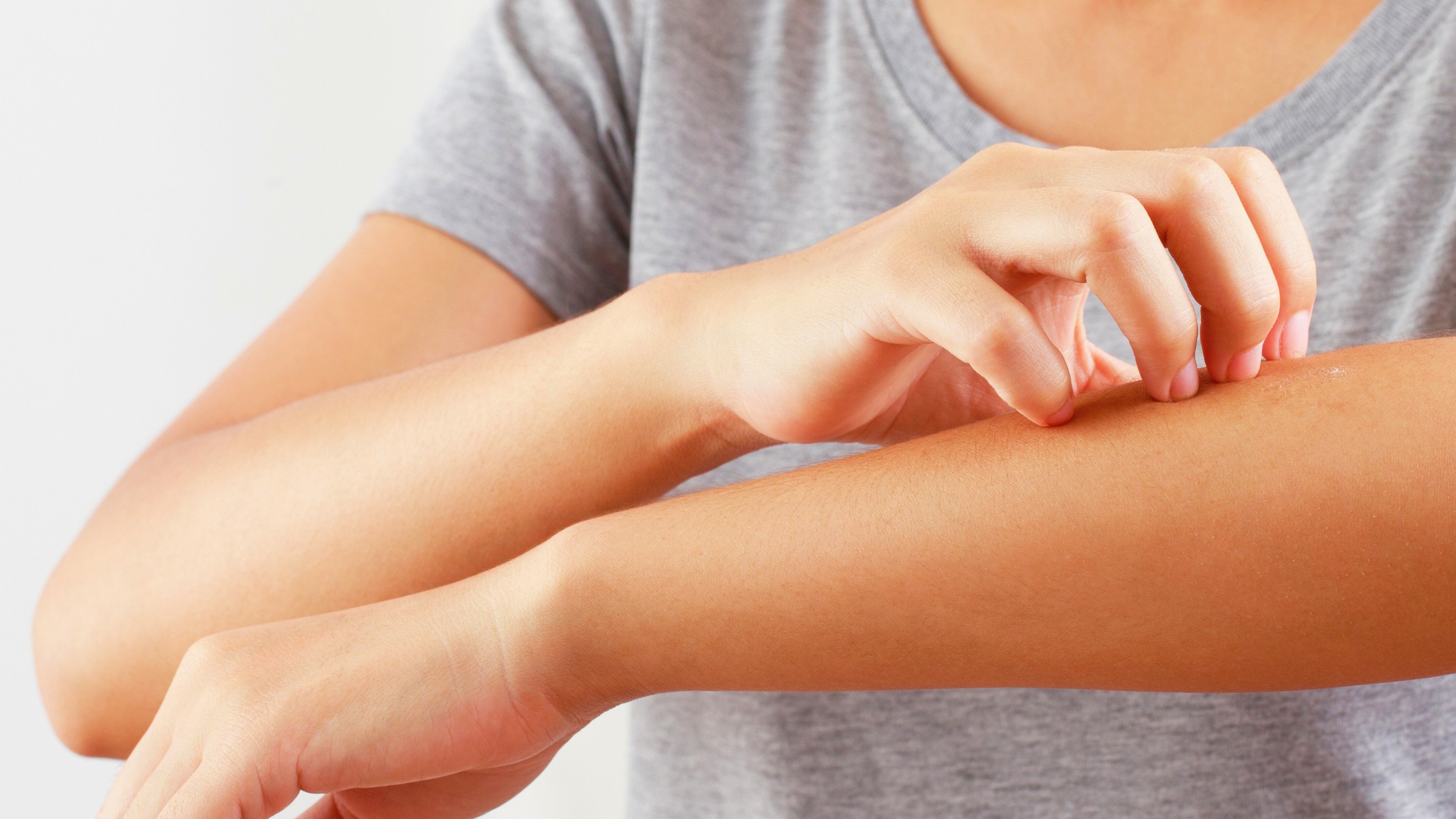 Preparing Your Skin for Allergy Season: Skincare Tips and Understanding Allergies